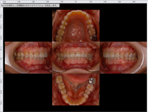 スクリーンショット 2017-10-12 15.02.29